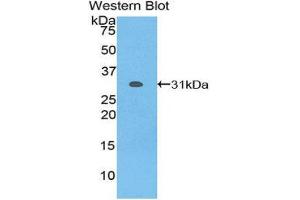 Western Blotting (WB) image for anti-Nicastrin (NCSTN) (AA 420-655) antibody (ABIN1859974) (Nicastrin Antikörper  (AA 420-655))