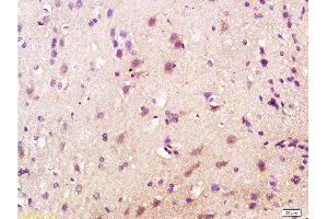 Formalin-fixed and paraffin embedded rat brain labeled with Anti-CD200R/Orexin receptor Polyclonal Antibody, Unconjugated  at 1:200 followed by conjugation to the secondary antibody and DAB staining. (OX1R/OX2R Antikörper  (AA 321-425))