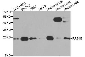 Western blot analysis of extracts of various cell lines, using RAB1B antibody. (RAB1B Antikörper)