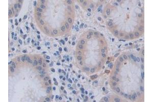 Immunohistochemistry (IHC) image for anti-Tumor Necrosis Factor (Ligand) Superfamily, Member 9 (TNFSF9) (AA 42-253) antibody (ABIN7441109)