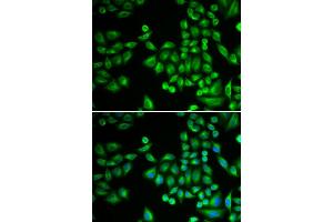 Immunofluorescence (IF) image for anti-Protein tyrosine Phosphatase, Non-Receptor Type 1 (PTPN1) antibody (ABIN1980139) (PTPN1 Antikörper)