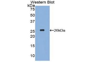 Detection of Recombinant NUP133, Mouse using Polyclonal Antibody to Nucleoporin 133 (NUP133)