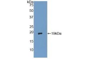 Detection of Recombinant dSIP, Human using Polyclonal Antibody to Delta-Sleep Inducing Peptide (dSIP) (TSC22D3 Antikörper  (AA 1-134))