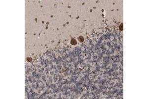 Immunohistochemical staining of human cerebellum with SOWAHB polyclonal antibody  shows strong cytoplasmic and nuclear positivity in Purkinje cells and molecular layer. (SOWAHB Antikörper)