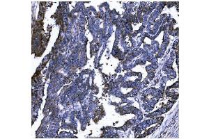 IHC analysis of GSDMD using anti-GSDMD antibody (ABIN7599433). (GSDMD Antikörper  (AA 1-484))