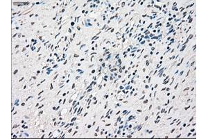 Immunohistochemical staining of paraffin-embedded Ovary tissue using anti-RAD9Amouse monoclonal antibody. (RAD9A Antikörper)