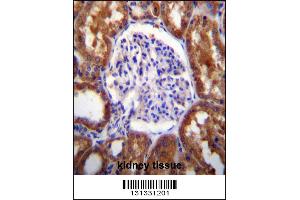 SLC12A6 Antibody immunohistochemistry analysis in formalin fixed and paraffin embedded human kidney tissue followed by peroxidase conjugation of the secondary antibody and DAB staining. (SLC12A6 Antikörper  (N-Term))