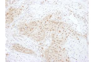 Immunohistochemistry (IHC) image for anti-Proteasome (Prosome, Macropain) 26S Subunit, Non-ATPase, 7 (PSMD7) (AA 150-200) antibody (ABIN7454967)