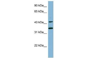 BLNK antibody used at 1 ug/ml to detect target protein. (B-Cell Linker Antikörper  (Middle Region))