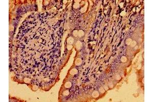 Immunohistochemistry of paraffin-embedded human small intestine tissue using ABIN7169226 at dilution of 1:100 (WNK2 Antikörper  (AA 1177-1464))