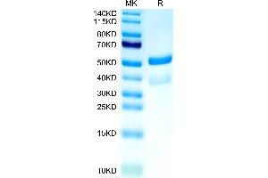 SDS-PAGE (SDS) image for Tumor Necrosis Factor Receptor Superfamily, Member 13B (TNFRSF13B) (AA 2-166) protein (Fc Tag) (ABIN7275684)