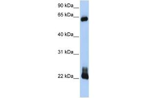 RHOD antibody used at 1 ug/ml to detect target protein.