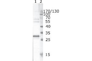 Western Blot testing of HIV-1 recombinant Nef protein. (HIV-1 Nef (AA 195-205) Antikörper)