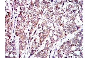 Image no. 1 for anti-V-Raf-1 Murine Leukemia Viral Oncogene Homolog 1 (RAF1) antibody (ABIN1500582) (RAF1 Antikörper)