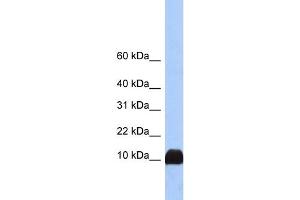 WB Suggested Anti-PFN1 Antibody Titration:  0. (PFN1 Antikörper  (N-Term))