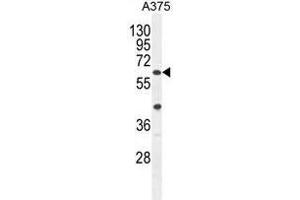 ACF Antibody (C-term) western blot analysis in A375 cell line lysates (35ug/lane). (A1CF Antikörper  (C-Term))