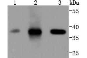 Lane 1: Jurkat, Lane 2: K562, Lane 3: Hela lysates probed with Cdk6 (4F7) Monoclonal Antibody  at 1:1000 overnight at 4˚C. (CDK6 Antikörper)