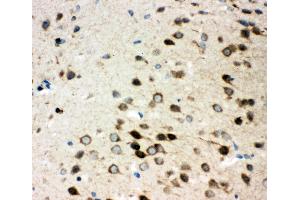 Immunohistochemistry (IHC) image for anti-Integrin, alpha 3 (ITGA3) (AA 51-67), (N-Term) antibody (ABIN3044222)
