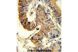 Immunohistochemistry (IHC) image for anti-Argininosuccinate Synthase 1 (ASS1) antibody (ABIN3002823)