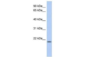 WB Suggested Anti-CHAC2 Antibody Titration: 0.