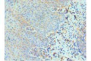 Immunohistochemistry of paraffin-embedded human tonsil tissue using ABIN7151466 at dilution of 1:100 (GCN2 Antikörper  (AA 1-300))