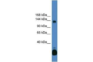 WB Suggested Anti-C10orf12 Antibody Titration: 0. (Lcor Antikörper  (C-Term))