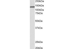 ABIN2564306 (0. (Oncostatin M Receptor Antikörper  (Internal Region))