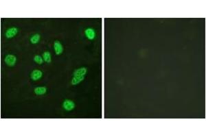 Immunofluorescence (IF) image for anti-V-Myb Myeloblastosis Viral Oncogene Homolog (Avian)-Like 2 (MYBL2) (AA 551-600) antibody (ABIN2888783) (MYBL2 Antikörper  (AA 551-600))