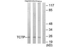 Western blot analysis of extracts from HepG2/COLO205/HeLa cells, using TCTP Antibody. (TPT1 Antikörper  (AA 71-120))