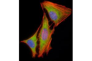 Immunofluorescent analysis of 4 % paraforldehyde-fixed, 0.