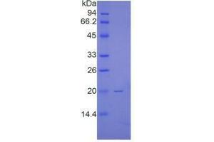 SDS-PAGE analysis of Human Renalase Protein. (RNLS Protein)