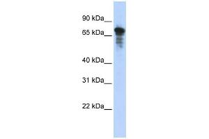 WB Suggested Anti-RHPN1 Antibody Titration: 0. (RHPN1 Antikörper  (Middle Region))