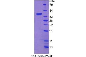 Image no. 1 for Protein tyrosine Phosphatase, Receptor Type, G (PTPRG) (AA 848-1119) protein (His tag) (ABIN6236999) (PTPRG Protein (AA 848-1119) (His tag))