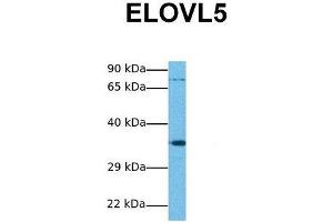 Host:  Rabbit  Target Name:  ELOVL5  Sample Tissue:  Human Jurkat  Antibody Dilution:  1. (ELOVL5 Antikörper  (N-Term))