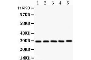 Western Blotting (WB) image for anti-serine/arginine-Rich Splicing Factor 1 (SRSF1) (AA 6-33), (N-Term) antibody (ABIN3043296)