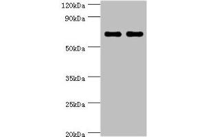 Western blot All lanes: BIRC2 antibody at 5 μg/mL Lane 1: HepG2 whole cell lysate Lane 2: K562 whole cell lysate Secondary Goat polyclonal to rabbit IgG at 1/10000 dilution Predicted band size: 70, 65 kDa Observed band size: 70 kDa (BIRC2 Antikörper  (AA 1-300))
