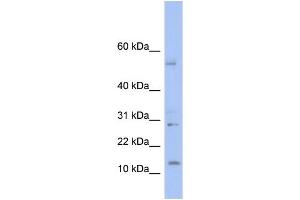 WB Suggested Anti-TD1 Antibody Titration: 0. (TLX1 Neighbor Antikörper  (Middle Region))