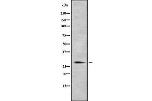 Western blot analysis of HLA-DRB1 using MCF7 whole cell lysates