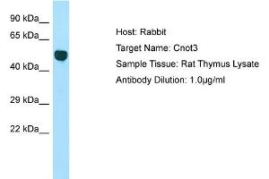 Host: Rabbit Target Name: Cnot3 Sample Type: Rat Thymus lysates Antibody Dilution: 1. (CNOT3 Antikörper  (Middle Region))
