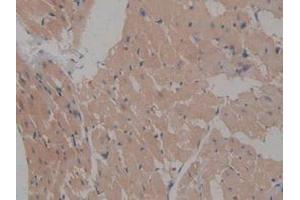 IHC-P analysis of Rat Heart Tissue, with DAB staining. (ICAM2 Antikörper  (AA 29-247))