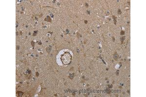 Immunohistochemistry of Human brain using MARK4 Polyclonal Antibody at dilution of 1:40 (MARK4 Antikörper)