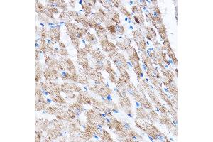 Immunohistochemistry of paraffin-embedded Rat heart using L Rabbit pAb (ABIN7268192) at dilution of 1:100 (40x lens).