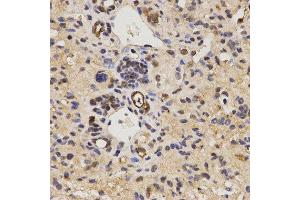 Immunohistochemistry (IHC) image for anti-Family with Sequence Similarity 160, Member B2 (FAM160B2) antibody (ABIN1872648) (FAM160B2 Antikörper)