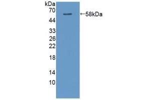 Detection of Recombinant CAMK2a, Rat using Polyclonal Antibody to Calcium/Calmodulin Dependent Protein Kinase II Alpha (CAMK2a) (CAMK2A Antikörper  (AA 1-478))