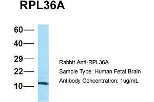 Host: Rabbit  Target Name: RPL36A  Sample Tissue: Human Fetal Brain  Antibody Dilution: 1. (RPL36AL Antikörper  (C-Term))