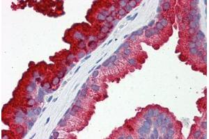Human Prostate: Formalin-Fixed, Paraffin-Embedded (FFPE) (RAB23 Antikörper  (AA 35-84))