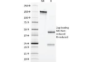 SDS-PAGE Analysis Purified Erythropoietin (EPO) Mouse Monoclonal Antibody (EPO/1367). (EPO Antikörper  (AA 28-162))