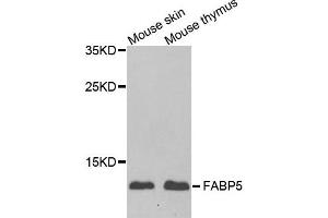 Western blot analysis of extracts of mouse skin and mouse thymus using FABP5 antibody.