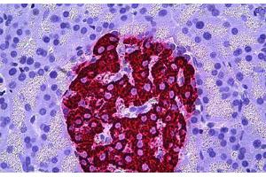 Human Pancreas, Islets of Langerhans: Formalin-Fixed, Paraffin-Embedded (FFPE) (Insulin Antikörper)