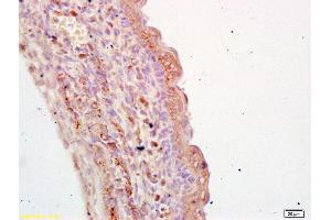 Formalin-fixed and paraffin embedded mouse embryo labeled with Anti-TGM3 Polyclonal Antibody, Unconjugated (ABIN736253) at 1:200 followed by conjugation to the secondary antibody and DAB staining (TGM3 Antikörper  (AA 601-693))